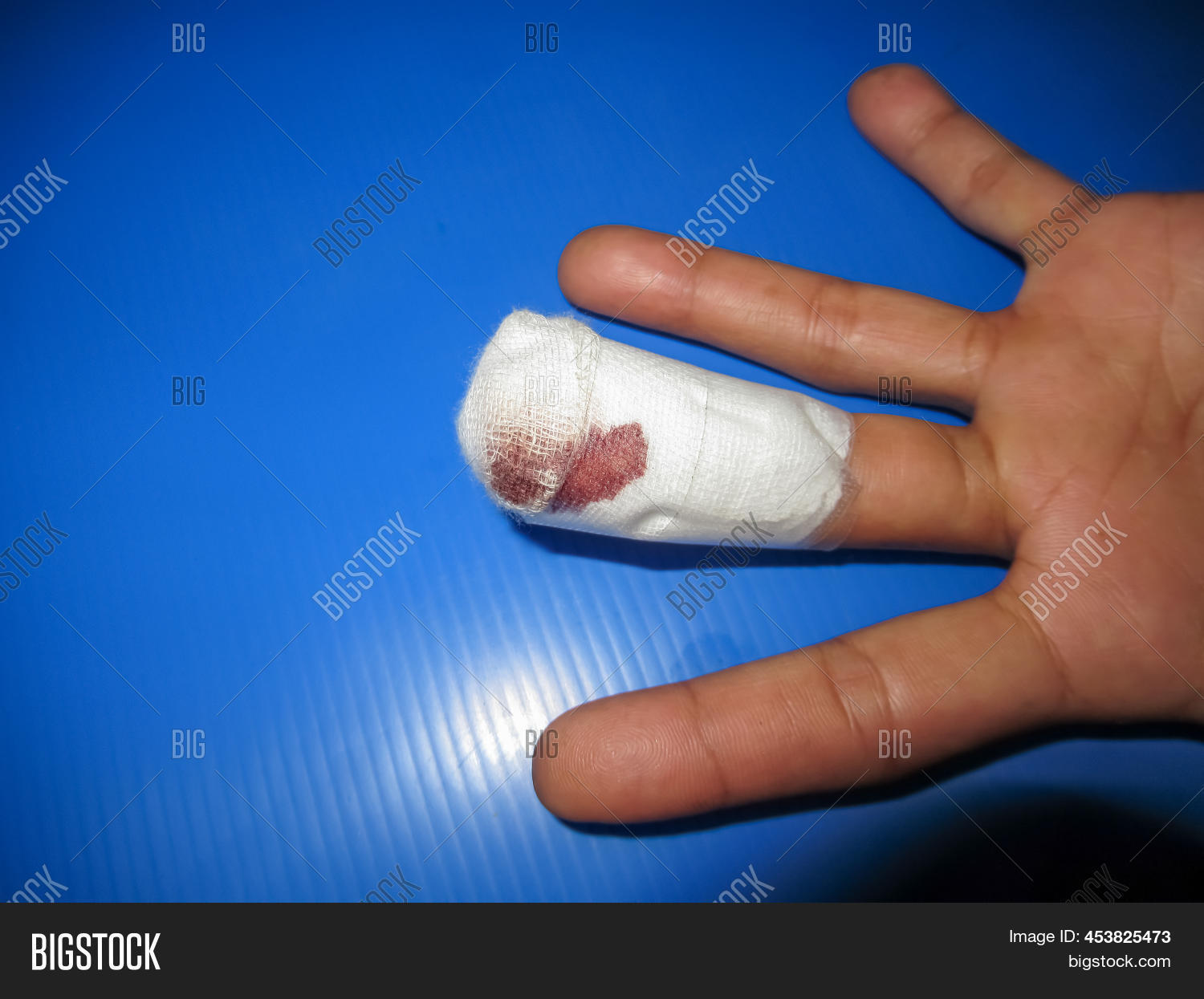 Wet Wound On Fingers Image & Photo (Free Trial) Bigstock