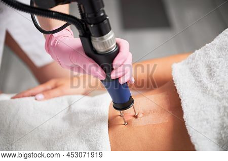 Close Up Cosmetologist Hand In Sterile Gloves Using Erbium Ablative Laser Machine While Performing L