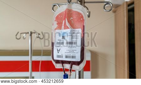 Ankara, Turkey - March 2021: Blood Transfusion Serum In Hospital Room With Blood Drip