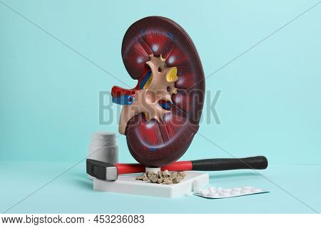 Kidney Model With Stones, Hammer And Pills On Turquoise Background