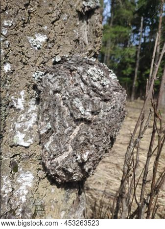 Inonotus Obliquus, Chaga, Birch Mushroom On A Tree Trunk In The Forest. Antitumor And Gastritis Agen