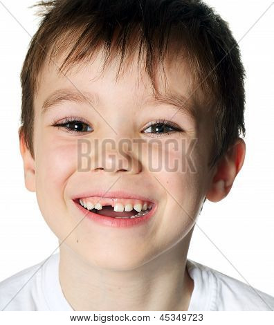 Bezzębny chłopiec