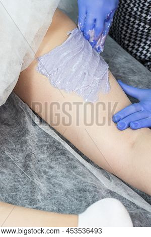 Worker Beautician Depilation With Hot Wax Woman`s Leg In Beauty Spa. Body Hair Removal. Hair Removal