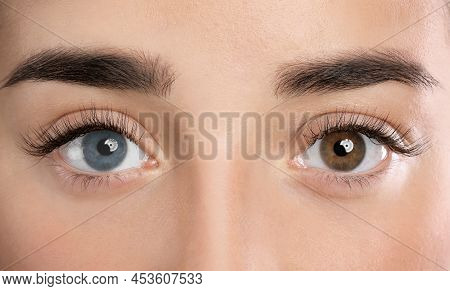 Woman With Different Colors Of Eyes, Closeup. Heterochromia Iridis