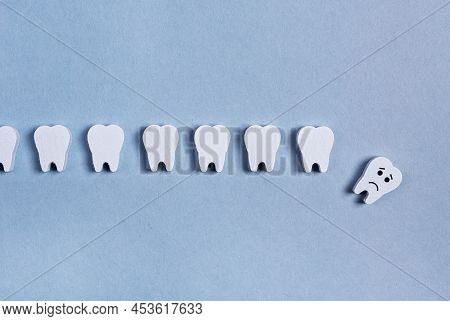 Teeth Row With Fallen Baby Milk Or Sick Adult One With Sad Emoji On Blue Background. Tooth Loss Caus