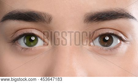 Woman With Different Colors Of Eyes, Closeup. Heterochromia Iridis