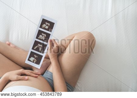 Pregnant Woman Sitting Holding Ultrasound Scan Photo. Asian Mother With Sonogram Of Her Unborn Baby.