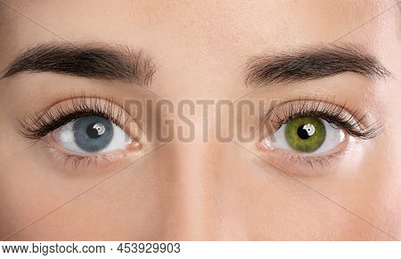 Woman With Different Colors Of Eyes, Closeup. Heterochromia Iridis