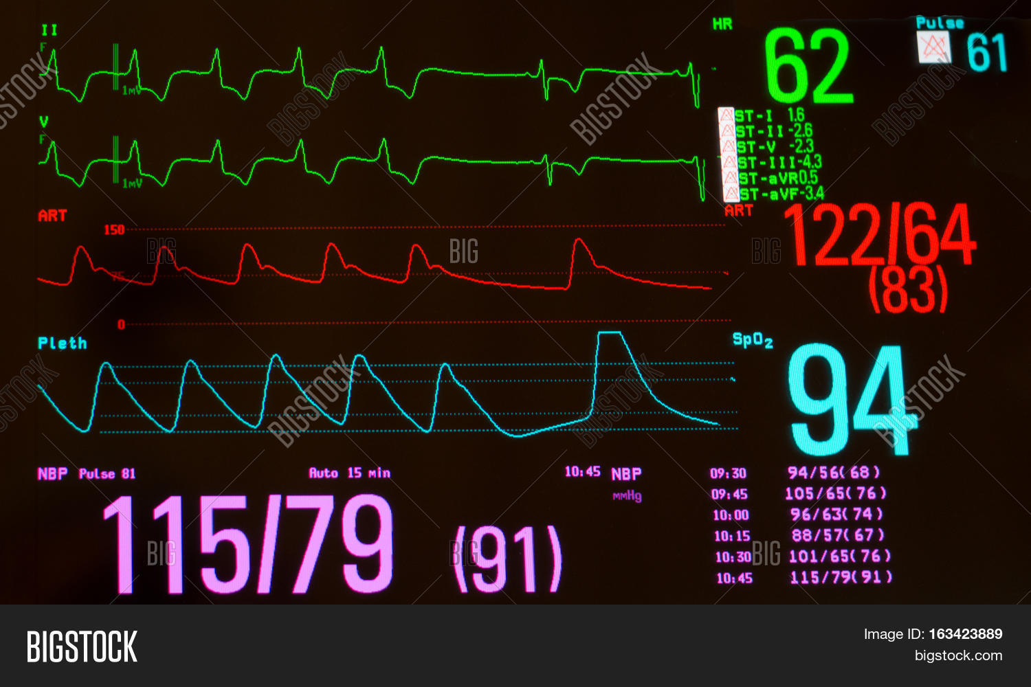 Close Monitor EKG Image & Photo (Free Trial) Bigstock