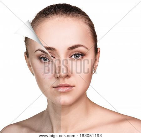 Layer with bad skin unstick from good healthy skin.