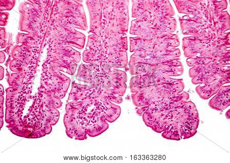 Villi of small intestine, light micrograph, magnification 100x