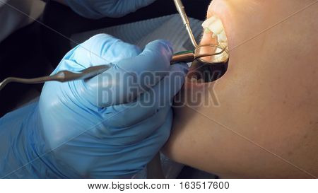 Woman at the dentist clinic office gets dental medical examination and treatment. Close up shot. Odontic and mouth health is important part of modern human life that dentistry help with.