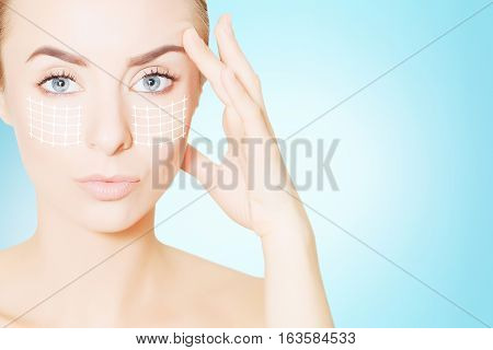 renovating skin concpet. woman face portrait with lifting marks