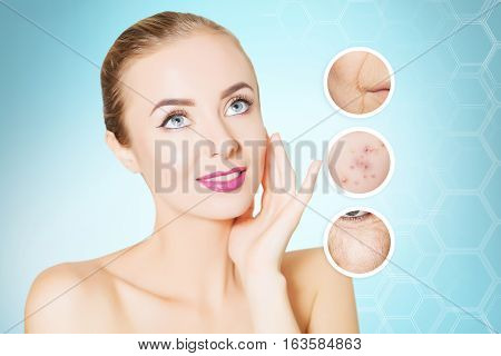 renovating skin concpet. woman face portrait with lifting marks