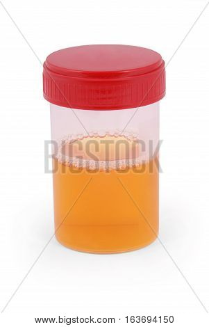 Sterile Medical container for urine with biomaterial. Clipping path inside.
