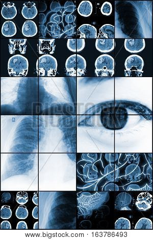Medical study results in the mosaic background.