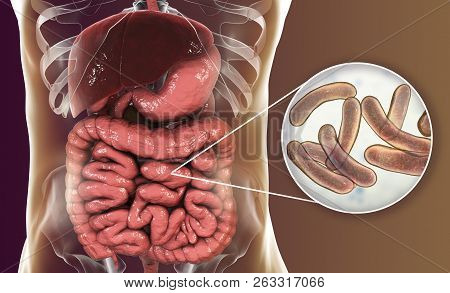Vibrio Cholerae Bacteria In Small Intestine, 3d Illustration. Bacterium Which Causes Cholera Disease