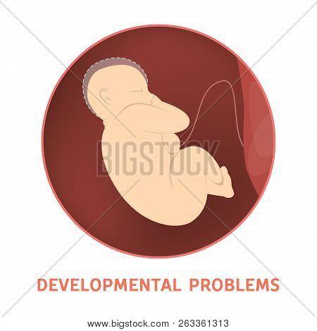 Medical Reasons For Cesarean Delivery Or C-section