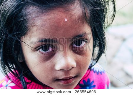 Bandipur Nepal October 15, 2018 Closeup Of Young Children Playing And Having Fun Together In Bandipu