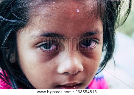 Bandipur Nepal October 15, 2018 Closeup Of Young Children Playing And Having Fun Together In Bandipu