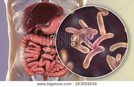 Vibrio Cholerae Bacteria In Small Intestine, 3d Illustration. Bacterium Which Causes Cholera Disease