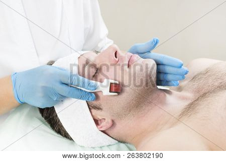 The Man Undergoes The Procedure Of Medical Micro Needle Therapy With A Modern Medical Instrument Der