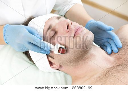 The Man Undergoes The Procedure Of Medical Micro Needle Therapy With A Modern Medical Instrument Der
