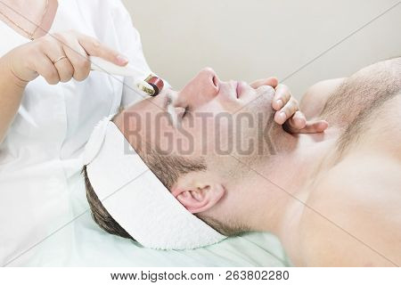 The Man Undergoes The Procedure Of Medical Micro Needle Therapy With A Modern Medical Instrument Der