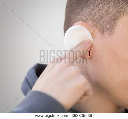The Man Is Bleeding From The Ear. Earache. Close Up. Isolated On A Grey Background.