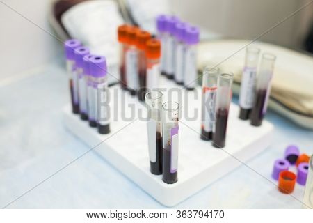 Laboratory Test Tubes Fullfilled With Different Blood Samples