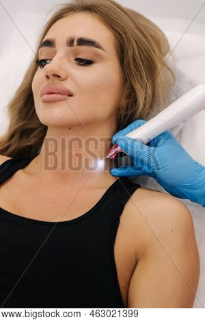 Plasma Pen Reducing Neoplasm Around Neck On Young Woman. Woman At Cosmetology Clinic Taking A Beauty