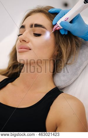 Plasma Pen Reducing Wrinkles Around Eyes On Young Woman. Woman At Cosmetology Clinic Taking A Beauty