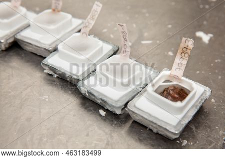 Embedded Tissues In Paraffin Blocks For Sectioning. Pathology Laboratory. Cancer Diagnosis.