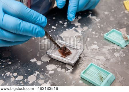 Scientist Embedding Tissues In Paraffin Blocks For Sectioning. Pathology Laboratory. Cancer Diagnosi