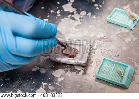 Scientist Embedding Tissues In Paraffin Blocks For Sectioning. Pathology Laboratory. Cancer Diagnosi