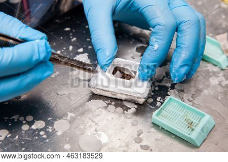 Scientist Embedding Tissues In Paraffin Blocks For Sectioning. Pathology Laboratory. Cancer Diagnosi