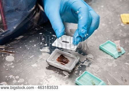 Scientist Embedding Tissues In Paraffin Blocks For Sectioning. Pathology Laboratory. Cancer Diagnosi