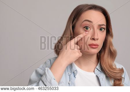 Woman With Yellow Eyes On Grey Background, Space For Text. Liver Problems Symptom