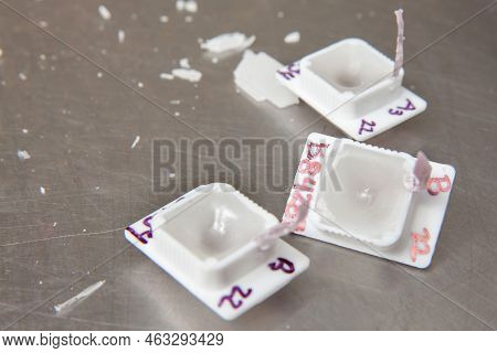 Preparation Of Paraffin Blocks Containing Biopsy Tissue For Sectioning. Pathology Laboratory. Cancer