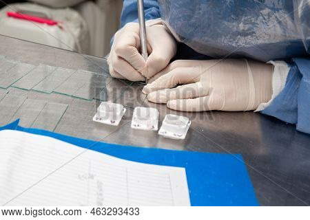 Scientist Preparing Paraffin Blocks Containing Biopsy Tissue For Sectioning. Pathology Laboratory. C