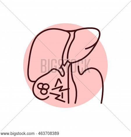 Cholelithiasis Liver Color Line Icon. Human Diseases.