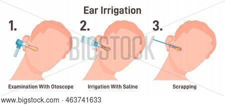 Ent Doctor Irrigate Ears. Doctor Checking Ear Canals, Removing