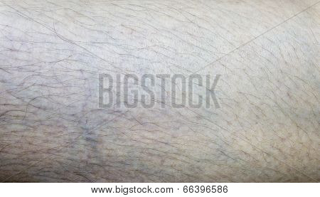 Skin Texture Background.