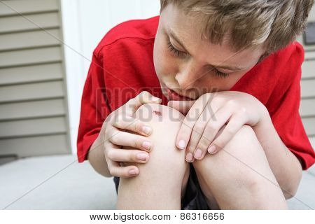 Young boy examining a scraped knee