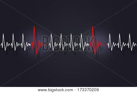 Tachycardia With Arrythmia