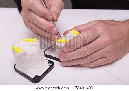 Technical shots of model on a dental prothetic laboratory. Dentist hands with model.