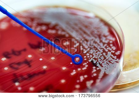 Loop For Exposure To Colonies Of White Bacteria Ferment Lactose Culture On Macconkey Agar In Microbi