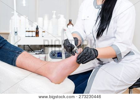 Podology Treatment. Podiatrist Treats Foot. Podiatry Doctor Or Dermatologist Treats The Patient In M