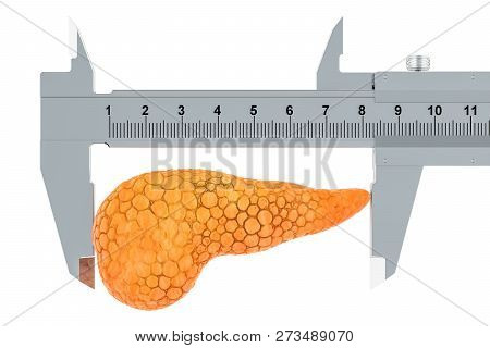 Human Pancreas With Vernier Caliper. Diagnosis And Treatment Of Pancreatic Concept, 3d Rendering