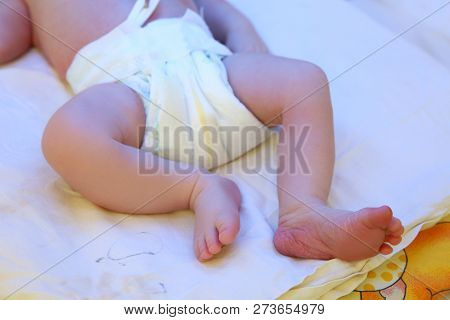Newborn Child Under Ultraviolet Light In Hospital, Closeup